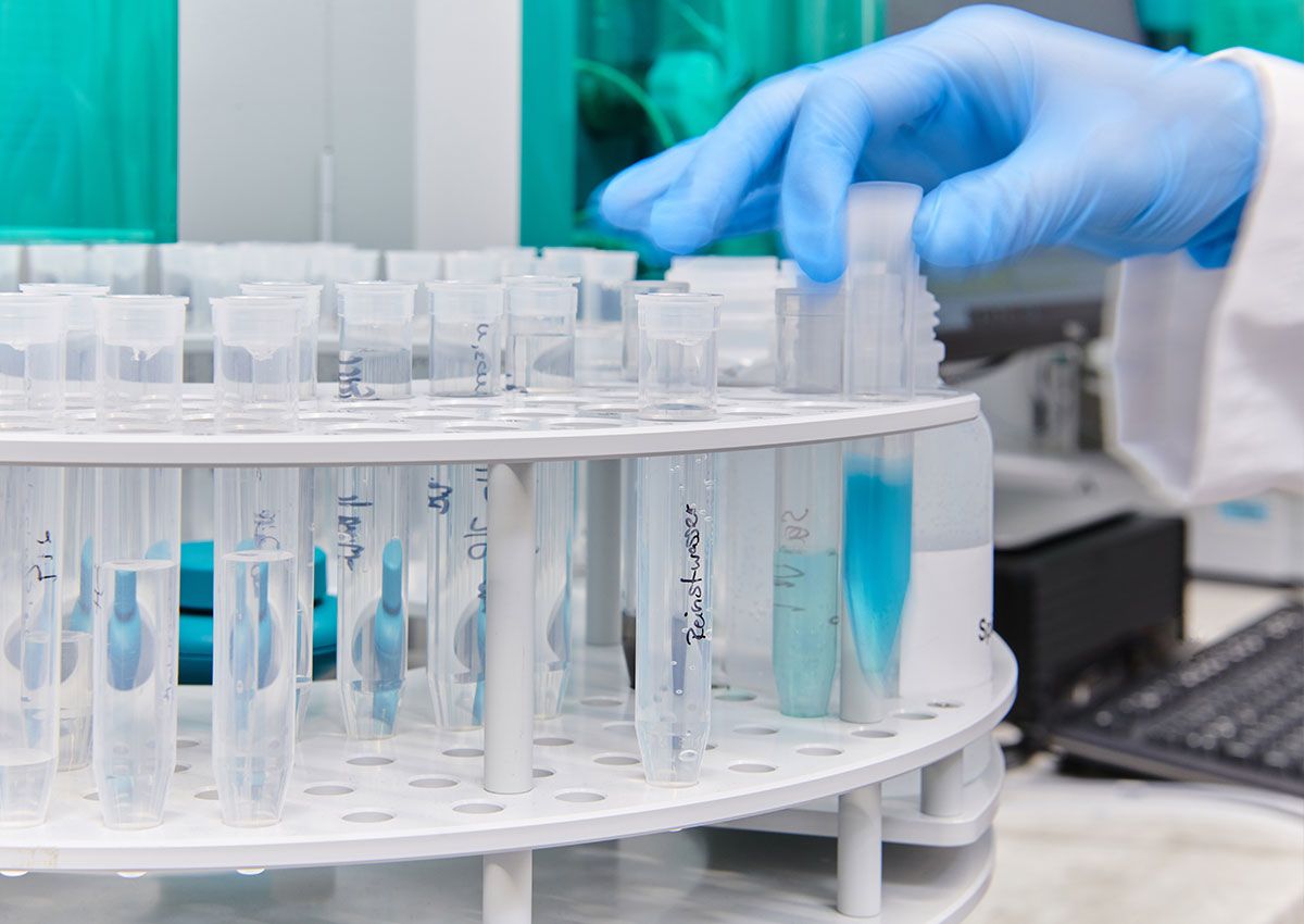 Sample preparation for high-performance liquid chromatography (HPLC)
